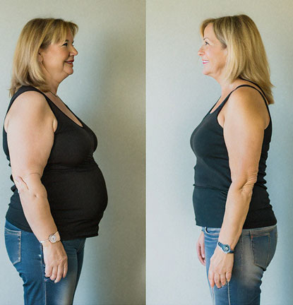 beforeafter-img